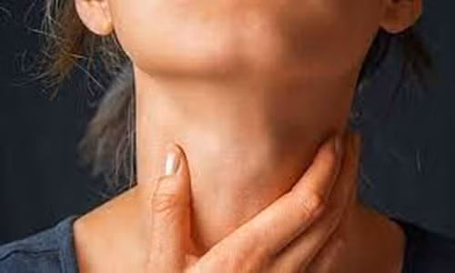 Đàn ông có nhiều khả năng bị ung thư hạch hơn phụ nữ. Đồng thời, những người có khả năng miễn dịch thấp, mắc bệnh AIDS, cấy ghép nội tạng hoặc tủy xương, sử dụng thuốc ức chế miễn dịch hoặc viêm gan C, Helicobacter pylori và virus herpes ở người loại IV và loại 8, hội chứng chuyển hóa và người cao tuổi có nguy cơ mắc ung thư hạch cao hơn những người khác.