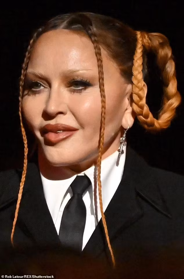 Xuất hiện trong buổi lễ trao giải Grammy mới đây, nữ danh ca Madonna lại gây sốc khi để lộ khuôn mặt sưng phù vì thẩm mỹ. (Ảnh: Rex)