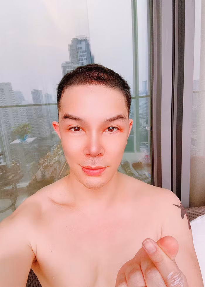 Nathan Lee trong the nao sau khi phau thuat vung dau?