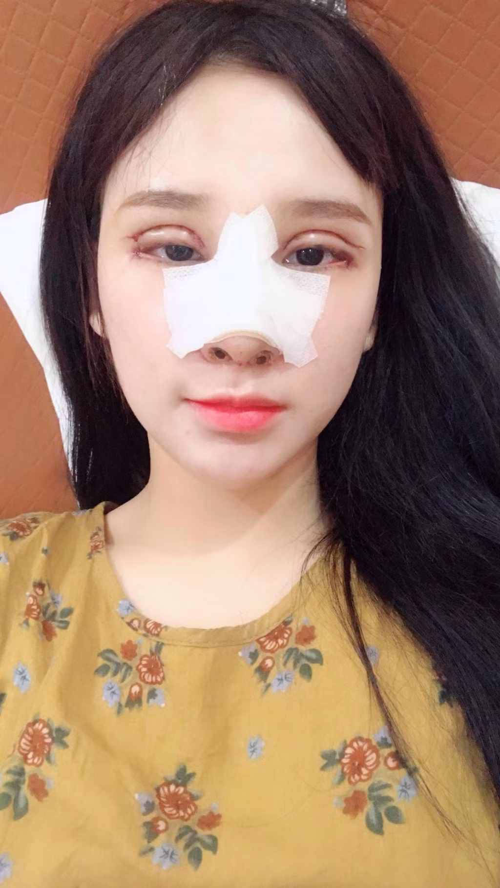 Không lâu sau khi tham gia show hẹn hò, "nữ hoàng nhạc chế" bất ngờ công khai phẫu thuật thẩm mỹ. Ảnh: Vietnammoi.
