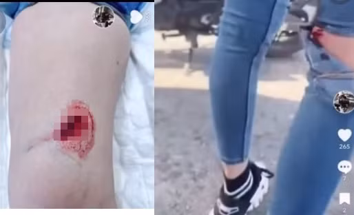 Mỹ nhân gốc Trà Vinh cho biết sau khi được điều trị và băng bó vết thương, cô không cảm thấy đau vì còn thuốc tê. Sau đó có thể sẽ đau và nhức, còn chỗ trầy xước khá rát. Bị thương sau tai nạn khiến Ngọc Trinh "than trời" với đàn anh: "Em đang ở nhà mà, đâu có đi đâu được nữa đâu".