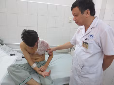 Cảnh báo bệnh nhân bỏng tăng mạnh do nắng nóng - Hình 2 Canh bao benh nhan bong tang manh do nang nong-Hinh-2