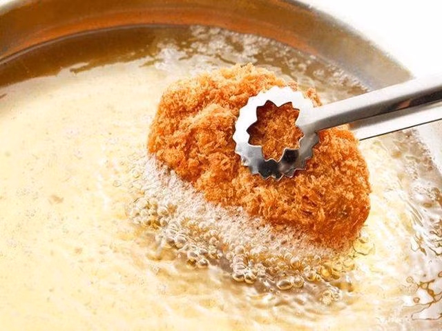 Nghiện gà rán, trà sữa và nhận kết đắng khi đi khám - Hình 3 Nghien ga ran, tra sua va nhan ket dang khi di kham-Hinh-3