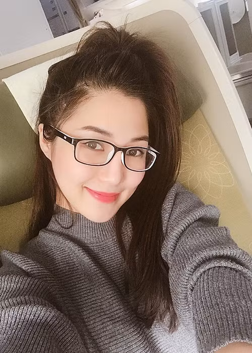 Tuy nhiên, do sử dụng kính áp tròng thường xuyên, đầu năm 2018, Hương Tràm bị viêm kết mạc, gần như mất thị giác. Ảnh: FBNV