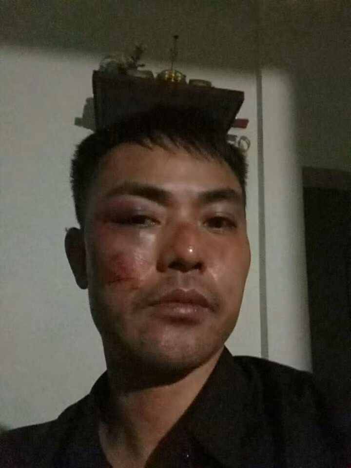 Khuôn mặt của anh Tiến trước đó bị nhóm đối tượng đánh đập.