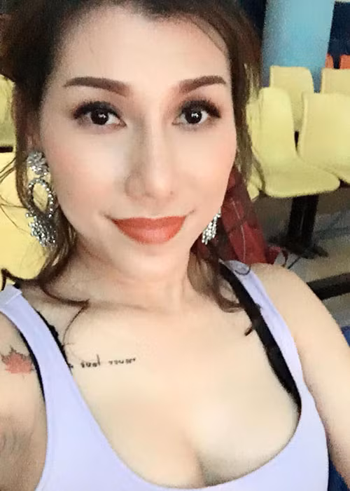 Nữ ca sĩ không sợ đặt túi ngực mới sau sự cố.