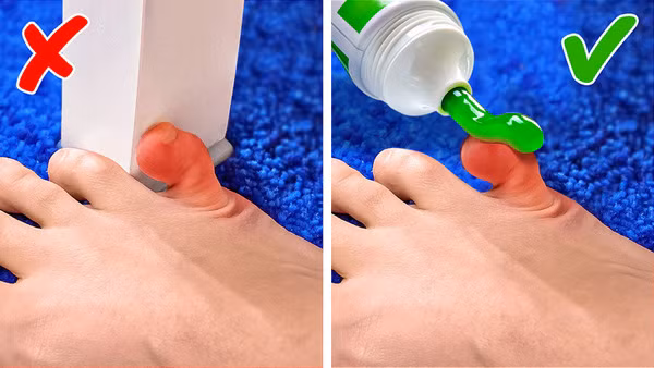 Các thành phần trong kem đánh răng có khả năng chống viêm, diệt khuẩn. Kem đánh răng không chỉ phát huy tác dụng với vết sưng không hở da, nó còn rất hữu ích trong việc giảm đau do ong đốt.