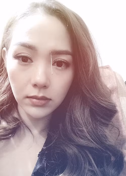 Bị trật chân trong đêm diễn ở Ninh Bình, Minh Hằng phải hủy buổi tham gia lễ khai mạc liên hoan phim ở Đà Nẵng.