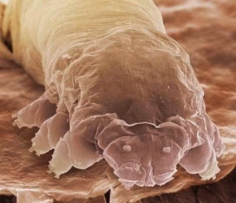 Chân dung một con quái vật ký sinh trùng Demodex khiến nhiều người khiếp sợ. (Nguồn Boredom Therapy)