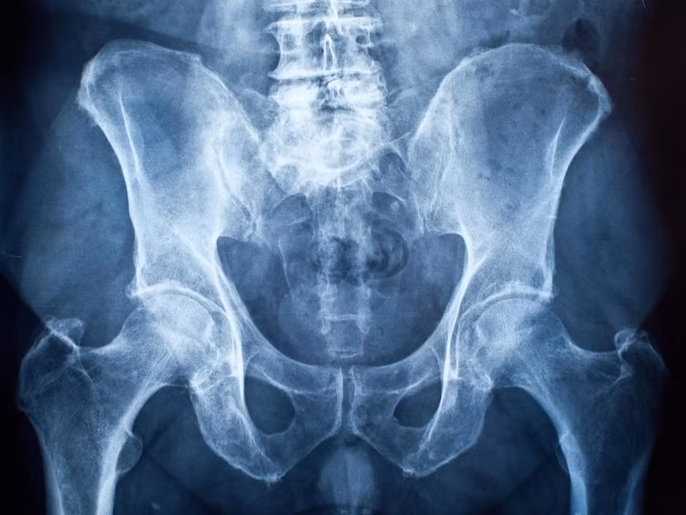 8. Khác với nhiều loài động vật có vú, con người không có xương dương vật (baculum). Sự cạnh tranh giao phối ở loài người đã giảm dần, chế độ một vợ một chồng phổ biến hơn, khiến xương này không còn cần thiết và biến mất.