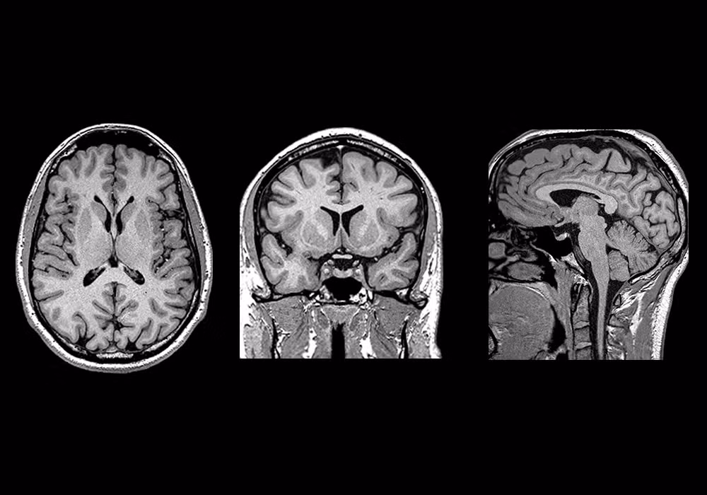 Một tế bào neuron thần kinh có đường kính khoảng 4 - 100 micromet, nhưng máy MRI mạnh nhất hiện nay chỉ có thể quan sát được vật thể đường kính nhỏ hơn 1000 micromet. Nếu dự án thành công, vật thể nhỏ cỡ 1 micromet cũng có thể quan sát được.