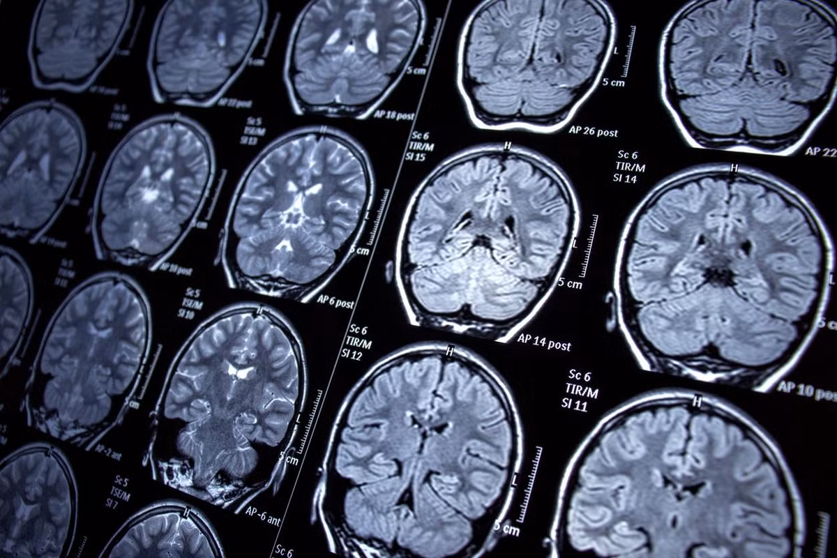 Quá trình thiết kế và phát triển công nghệ có thể tốn nhiều chi phí. Tuy nhiên, công nghệ MRI sau này có thể thay thế hoàn toàn tia X vì không tạo ra phóng xạ, không gây tổn hại cho cơ thể.
