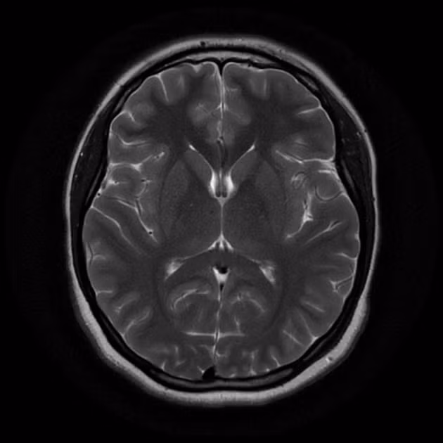 Dự án xây dựng máy MRI mạnh nhất đã được chính phủ phê duyệt với sự cố vấn của giáo sư Zhao Zhongxian. Các máy MRI thông thường hiện nay chỉ có thể tích lũy từ trường dao động khoảng 1,5 - 3 tesla, trong khi cỗ máy mạnh nhất hiện nay tại Mỹ và châu Âu là 11 tesla.