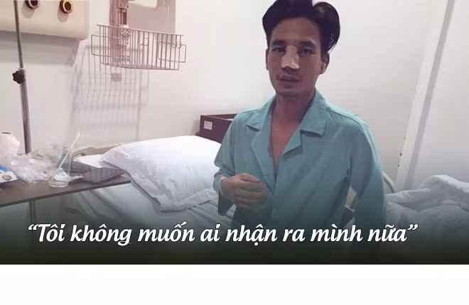 Tháng 7/2017, Lệ Rơi gây sốc khi công khai hình ảnh phẫu thuật thẩm mỹ. Anh muốn xóa bỏ hình ảnh "thảm họa âm nhạc" năm nào.