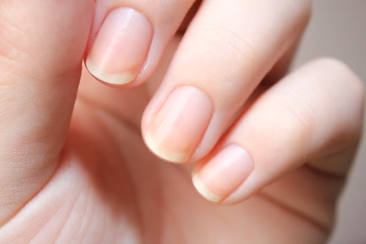 Móng tay nếu không được chăm sóc đúng cách có thể trở nên khô, yếu, dễ gãy. Một số người cho rằng chỉ cần sơn móng tay sẽ giúp củng cố cho móng chắc khỏe. Tuy nhiên các chuyên gia về móng khẳng định, móng tay giòn là do tiếp xúc liên tục với nước hoặc hóa chất mạnh được tìm thấy trong các loại sơn móng tay, nước tẩy rửa...