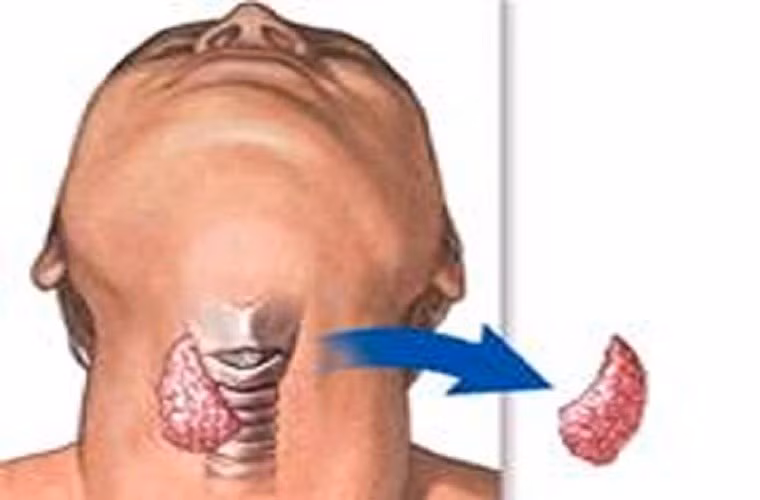 Nếu nhiệt độ của bạn dưới 36,33 độ C trong 2 ngày đo liên tiếp thì nên gặp bác sỹ để cân nhắc việc điều trị hormone tuyến giáp.