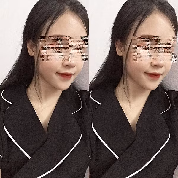 Sau khi bị chồng đánh, vết thương của cô gái khá nghiêm trọng. Tai chảy máu, môi bầm dập và tay chân có nhiều chỗ xước xát. Rất nhanh ngay sau đó, dân mạng đã truy tìm được Facebook của cô gái bất hạnh này. Được biết, cô gái có tên là P.M.Y, sống tại Hà Nội.