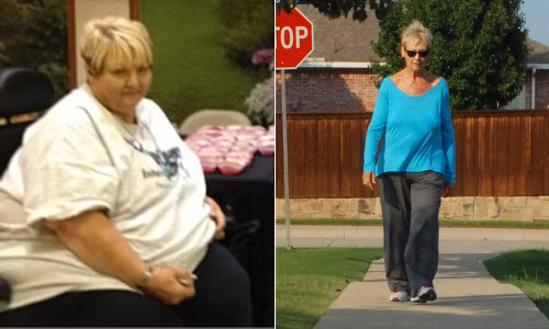  Brenda giảm 127kg. Brenda cảm thấy có một sự thay đổi lớn khi giảm được hơn 100kg . 