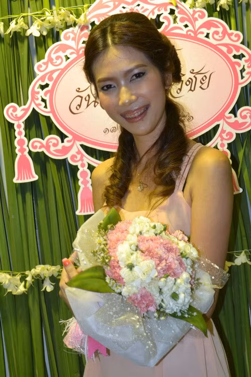 Shrill đã dùng đến đến rất nhiều phương pháp từ phẫu thuật chỉnh hình, phẫu thuật thẩm mỹ, tập luyện… để tạo nên sự thay đổi lớn về ngoại hình.
