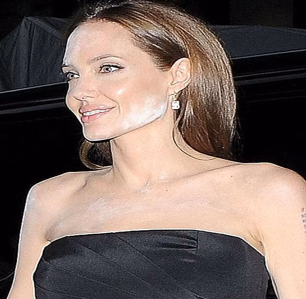 Không chỉ bà Bành Lệ Viện, nhiều người nổi tiếng như nữ diễn viên Angelina Jolie...