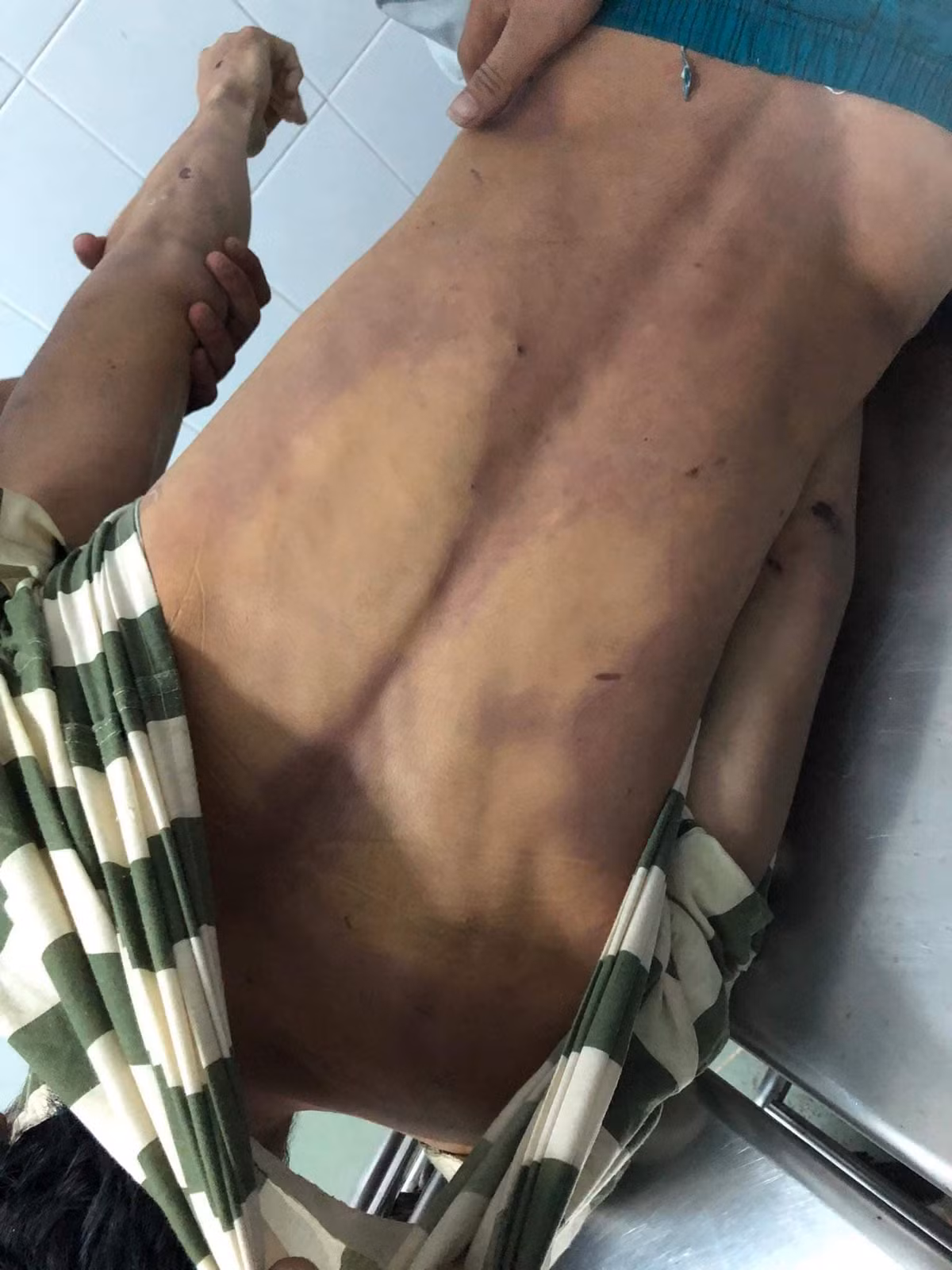 Nam thanh nien tu vong trong nha tam giu cong an o Dong Nai: Bi giang ho cung buong giam danh chet