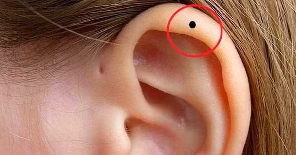 Một đôi tai tốt phải có dái tai dày, tai sát não, tai và khuôn mặt trắng, có nốt ruồi may mắn trên tai, thì người phụ nữ như vậy là người khéo léo, thông minh, có khả năng bộc lộ sự việc trong nháy mắt.