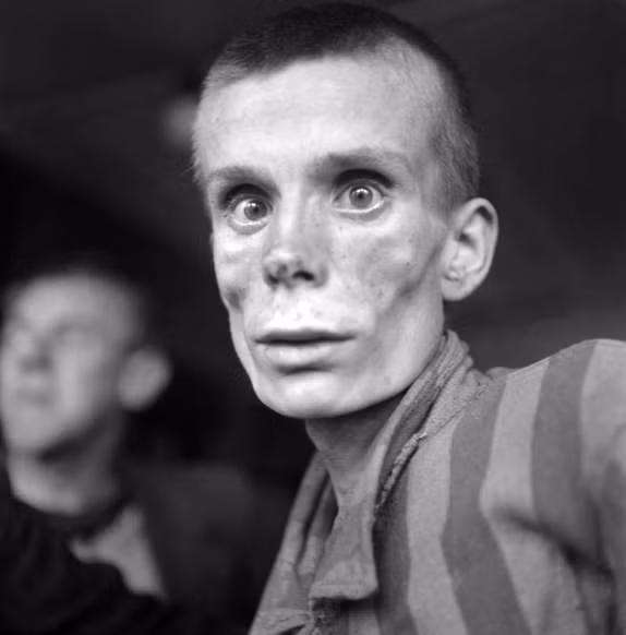 Một thanh niên sau khi được giải phóng khỏi trại tập trung Dachau ở Đức năm 1945.