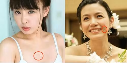 Nhung not ruoi xui xeo khien gia chu mat van ca doi-Hinh-5