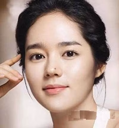 Nếu một người có nốt ruồi may mắn mọc ở khu vực xung quanh đầu mũi, chân mũi thì người đó sẽ là người rủng rỉnh về tiền bạc, không những giữ được tiền mà còn kiếm được rất nhiều tiền. Ảnh: phunu.news.