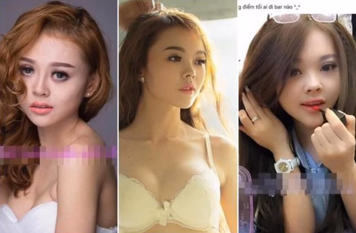 Cụ thể Trang Nemo đã sửa lông mày (7 lần), phun môi (3 lần), phun mí mắt (2 lần), sửa mũi (2 lần), gọn cánh mũi (1 lần), mở góc mắt (1 lần), tiêm dáng môi + tiêm tan (4 lần), làm cằm (1 lần), làm ngực (2 lần),...