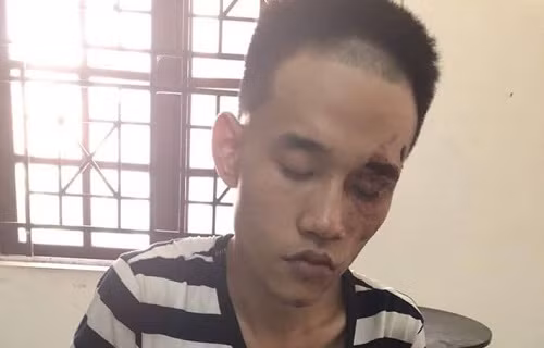 Nghi phạm cứa cổ bạn bố tử vong có biểu hiện bất thường Nghi pham cua co ban bo tu vong co bieu hien bat thuong