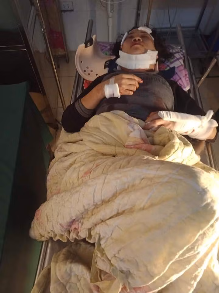 Chong danh vo nhap vien roi treo co chet tai nha