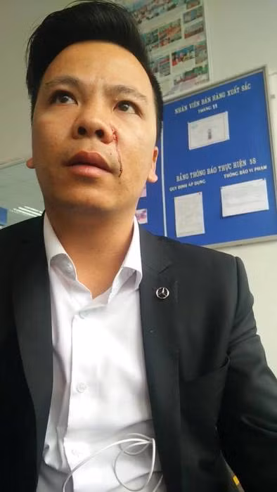 Isuzu Long Bien bao nhieu lan bi khach hang to ban xe 