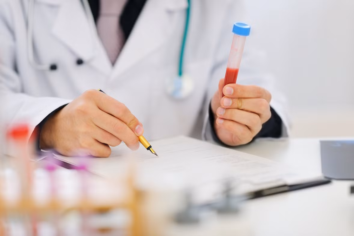 Bạn cần kiểm tra nồng độ hồng cầu, bạch cầu, tiểu cầu, hemoglobin, phết máu ngoại biên và tỉ lệ lắng của hồng cầu.