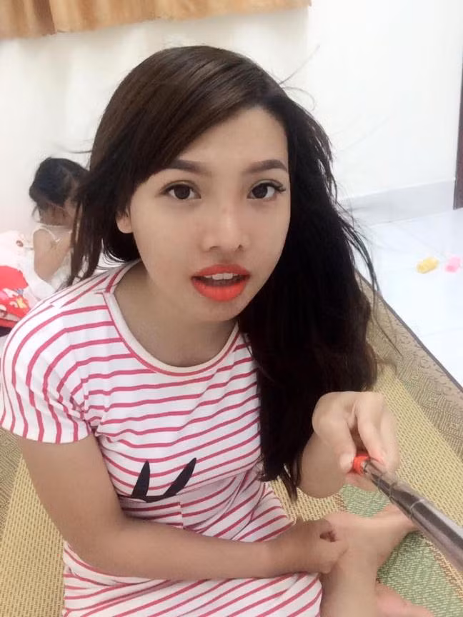 "Em thấy chị Vũ Thanh Quỳnh phẫu thuật thành công và thay đổi cuộc sống. Khi đó em định đăng ký chương trình Thay đổi cuộc sống nhưng lỡ mất mùa 2 còn mùa 3 không tổ chức. Em mới nói bố mẹ là “Mẹ ơi cho con vay tiền đi, sau này con làm con trả’. Tiền 150 triệu của bố mẹ 1 nửa, của em cùng dồn được 1 nửa. Ban đầu anh em, họ hàng phản đối rất nhiều, bố mẹ em cũng phản đối vì sợ phẫu thuật không thành công, tiền mất tật mang. Em mới lấy trường hợp chị Vũ Thanh Quỳnh thay đổi thành công để thuyết phục và trước đây mẹ em cũng bị thiệt thòi về nhan sắc nhiều nên mẹ cũng đồng ý cho em phẫu thuật".