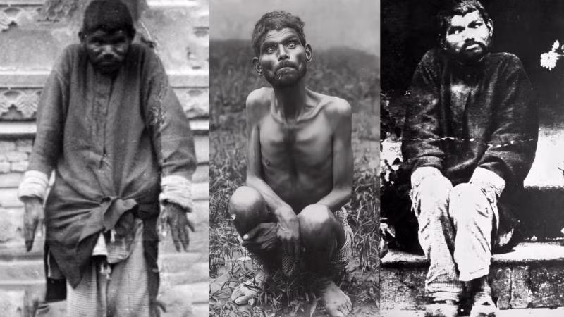 Theo đó, nhóm thợ săn đưa cậu bé "người rừng" được cho là 6 - 7 tuổi đến trại trẻ mồ côi truyền giáo Sekandra ở Agra. Tại đây, cậu bé được mọi người đặt tên là Dina Sanichar.