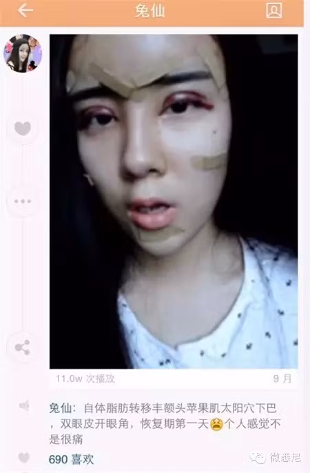 Thảm họa thẩm mỹ Lý Ân Hy trở thành chủ đề bàn tán rôm rả trên mạng xã hội Trung Quốc. Cô người mẫu tuổi teen bị các fan ném đá tả tơi vì quyết định thừa thãi và suy nghĩ thực sự khác người của cô.