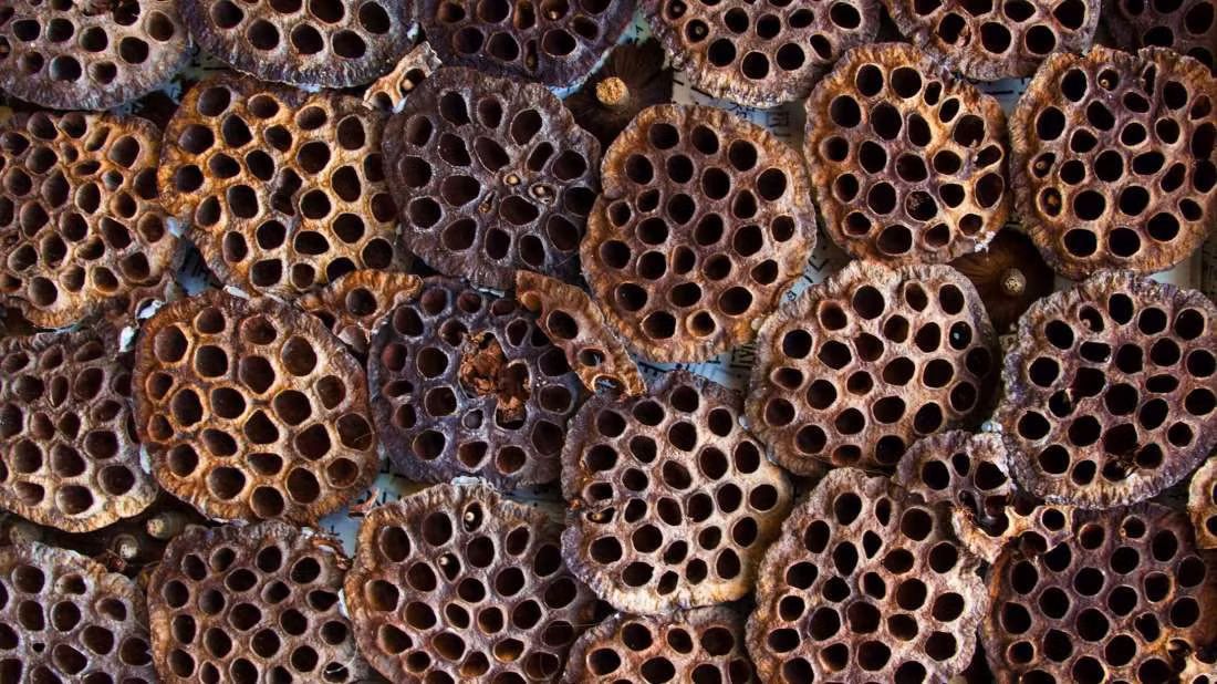 Kết quả nghiên cứu của các chuyên gia cho thấy người mắc hội chứng Trypophobia thường liên hệ những đồ vật có nhiều lỗ với sự nguy hiểm.