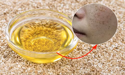 Chống lão hóa: Dầu mè có chứa một chất chống ôxy hóa làm giảm và ngăn ngừa nếp nhăn, ngăn ngừa quá trình oxy hóa, giữ cho da tươi mới và do đó làm chậm tốc độ lão hoá da. Trộn một vài giọt dầu mè với một giọt tinh dầu oải hương và xoa bóp lên da. Để lại nó qua đêm, cách này sẽ làm giảm các dấu hiệu lão hóa cũng như chống lại vi khuẩn và nhiễm trùng.