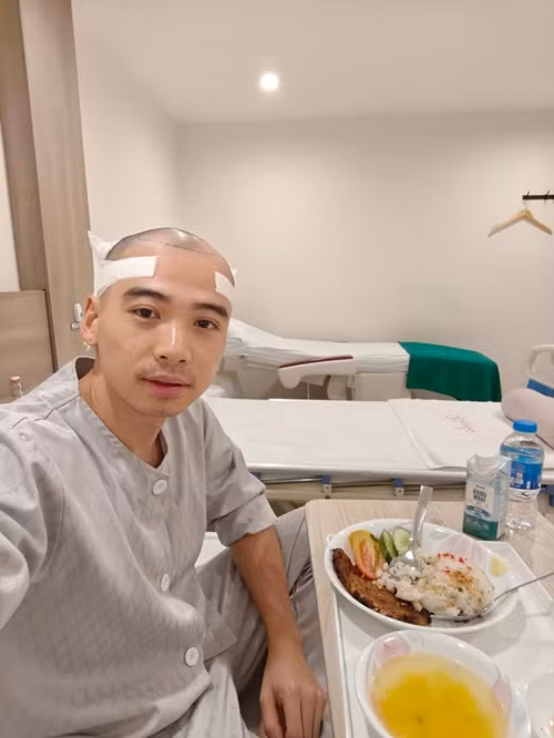 "Anh Khôi lên bàn mổ lấy nang tóc sau gáy và bắn cấy lên mặt trước của đầu rồi cả nhà ạ. Em Hen cản dữ lắm tại thấy anh đẹp lắm rồi. Nhưng anh quyết tâm quá, nên chúc anh vạn sự bình an, cấy tóc an toàn và đúng ý ảnh muốn. Ca này thực hiện khoảng 8-10 tiếng nên mọi người không liên lạc được ảnh đừng quá lo lắng nhé", Hoa hậu H'hen Niê chia sẻ về việc tân trang vẻ ngoài của Tuấn Khôi. Ảnh: FB Tuấn Khôi.