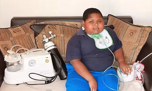 Cau be 10 tuoi nang 90kg vi khong the ngung an