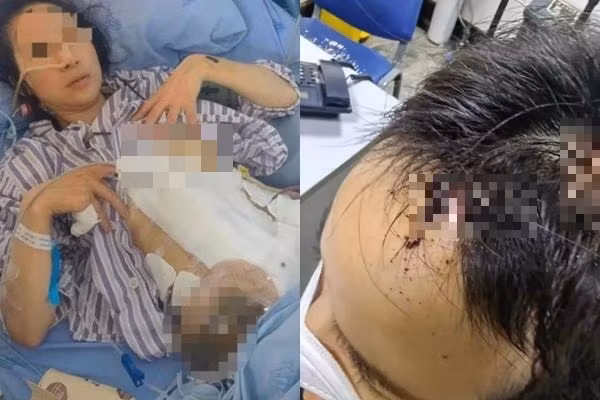 Hot girl xinh đẹp bị chồng bạo hành dã man gây phẫn nộ Hot girl xinh dep bi chong bao hanh da man gay phan no