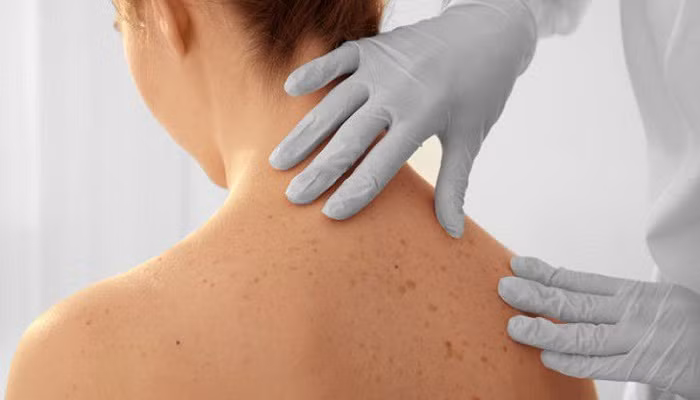 Khối u ung thư có đặc điểm chúng ngày càng to dần, cứng, khó đẩy, bề mặt thô ráp, không thể tự tiêu biến... Lúc này, bạn nên đi khám ở các bệnh viện chuyên K để đánh giá đúng tình hình.