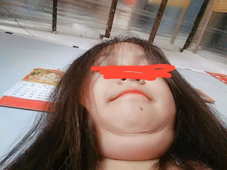 Cả thế giới cứ việc V-line đi, cằm nọng của tôi đang là hot trend.