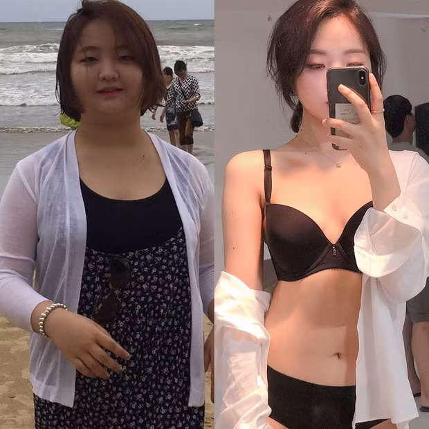 Hậu quả việc quá nặng khiến sức khỏe Hyun Ju gặp vấn đề. Cô nàng xuất hiện những cơn đau lưng, đau đầu, cao huyết áp, hay hạ đường huyết... Từ đó, cô gái Hàn Quốc nghiêm túc nghĩ tới việc thay đổi cân nặng.