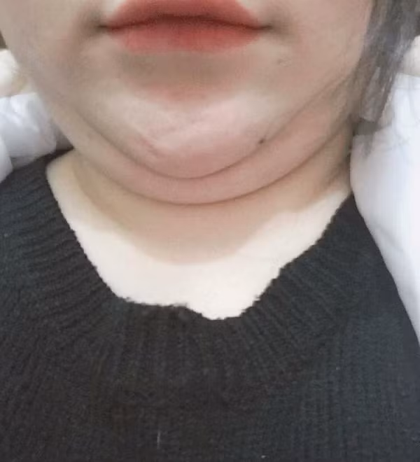 Còn nickname Minh Anh thì lại cho rằng: "Có ai định yêu người hai cằm như em không? Người thì tong teo, ăn bao nhiêu lên mỗi cái mặt. Cột tóc lên là bị nói mặt giống cái đĩa, lại phải xõa."