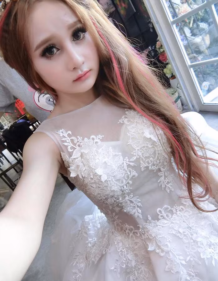 Cách đây chưa lâu, Thanh Vân quyết định thực hiện cuộc phẫu thuật chỉnh sửa lại gương mặt. Cô không ngại công khai trên Facebook cá nhân mặc cho lắm kẻ dèm pha chê bai.