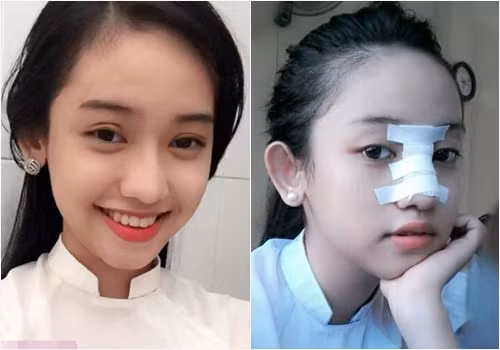 Nổi lên từ lùm xùm tình cảm với thiếu gia Phan Thành - vị hôn phu của hot girl Mi Du, Thúy Vi từ một cô gái vô danh bỗng chốc vụt trở thành sao và được nhiều người biết đến.