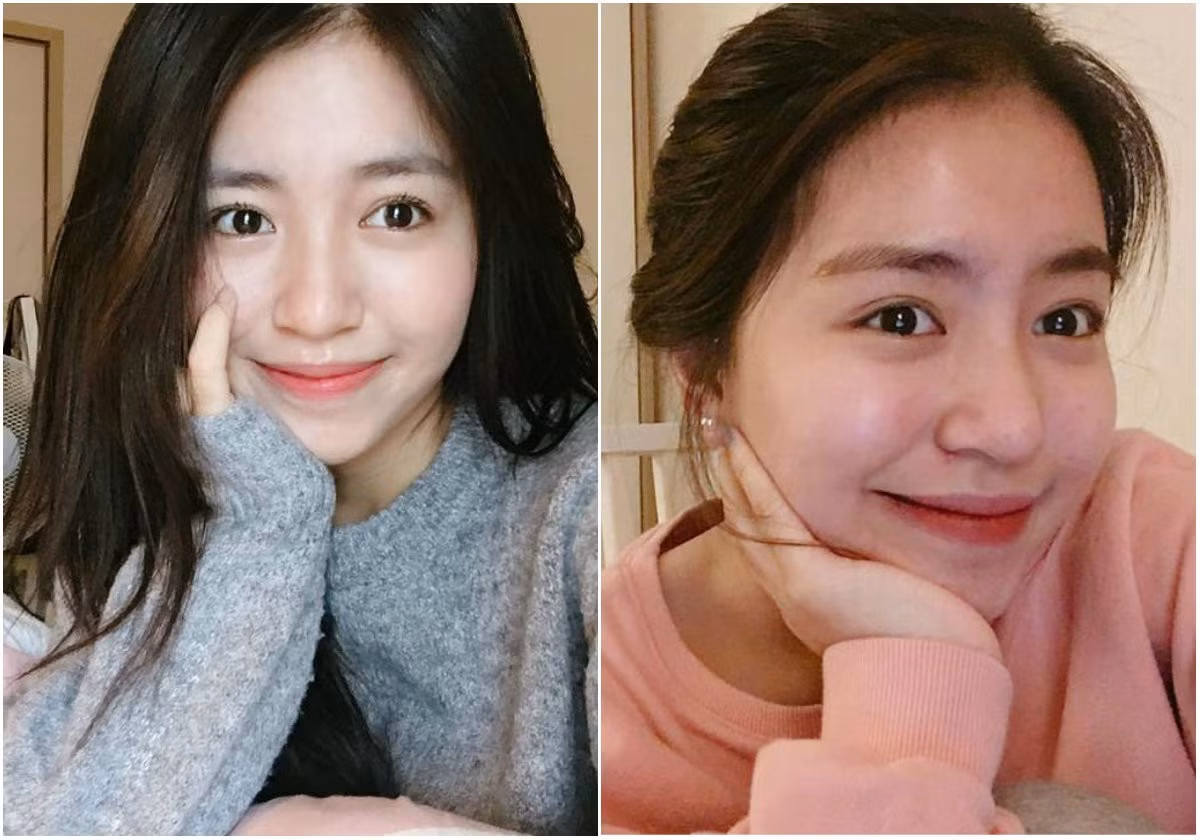 Khi xõa tóc, khuôn mặt của hot girl Mẫn Tiên nhìn cực trẻ trung và thon gọn nhưng khi vấn tóc lên cao, cô nàng này lộ rõ má phính.
