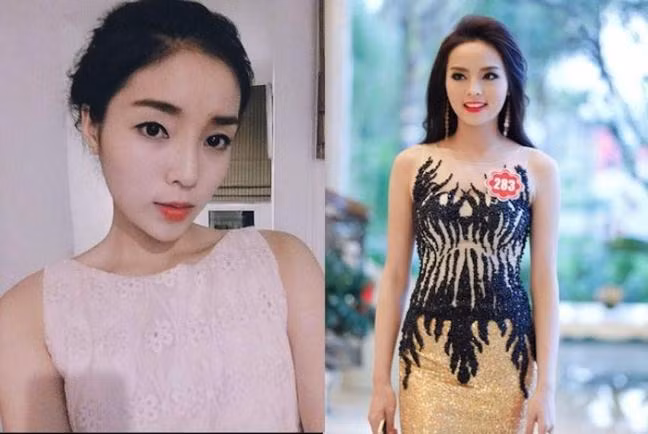 Cánh mũi vốn không được gọn của người đẹp Kỳ Duyên bỗng nhiên trở nên thẳng và nhỏ một cách khác thường